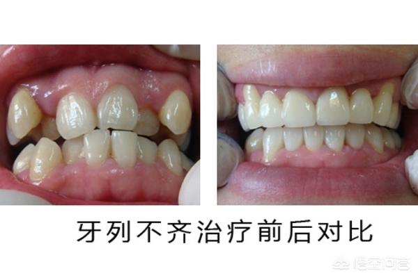 桐乡最新24小时牙医在线咨询方法分析(最方便真实的桐乡有没有24小时牙医方法)